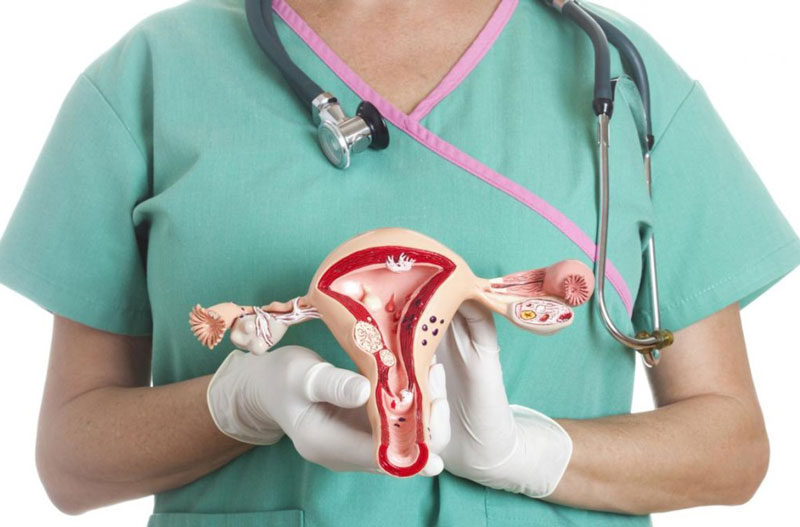 Một số điều bạn chưa biết về bệnh buồng trứng đa nang